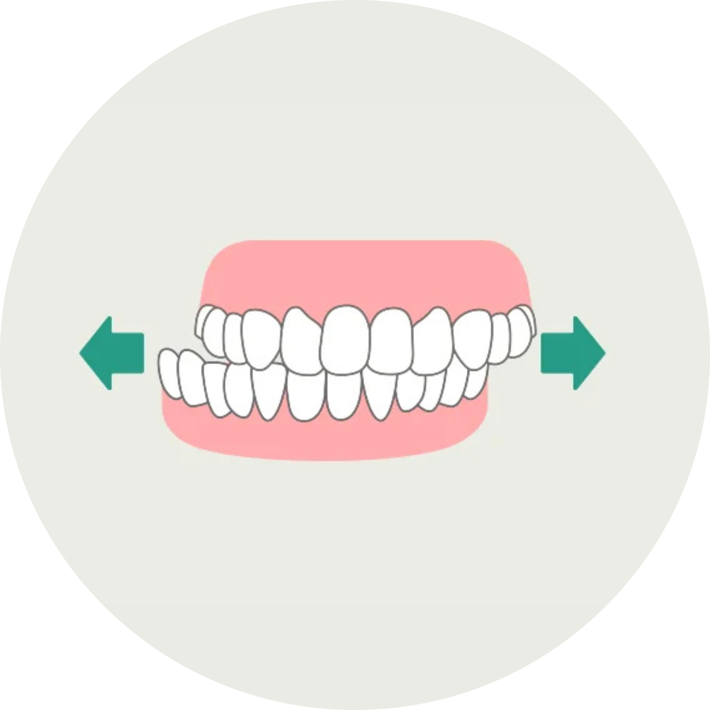 歯ぎしり グラインディング 歯ぎしりの種類 飯田橋IB歯科 飯田橋駅徒歩1分