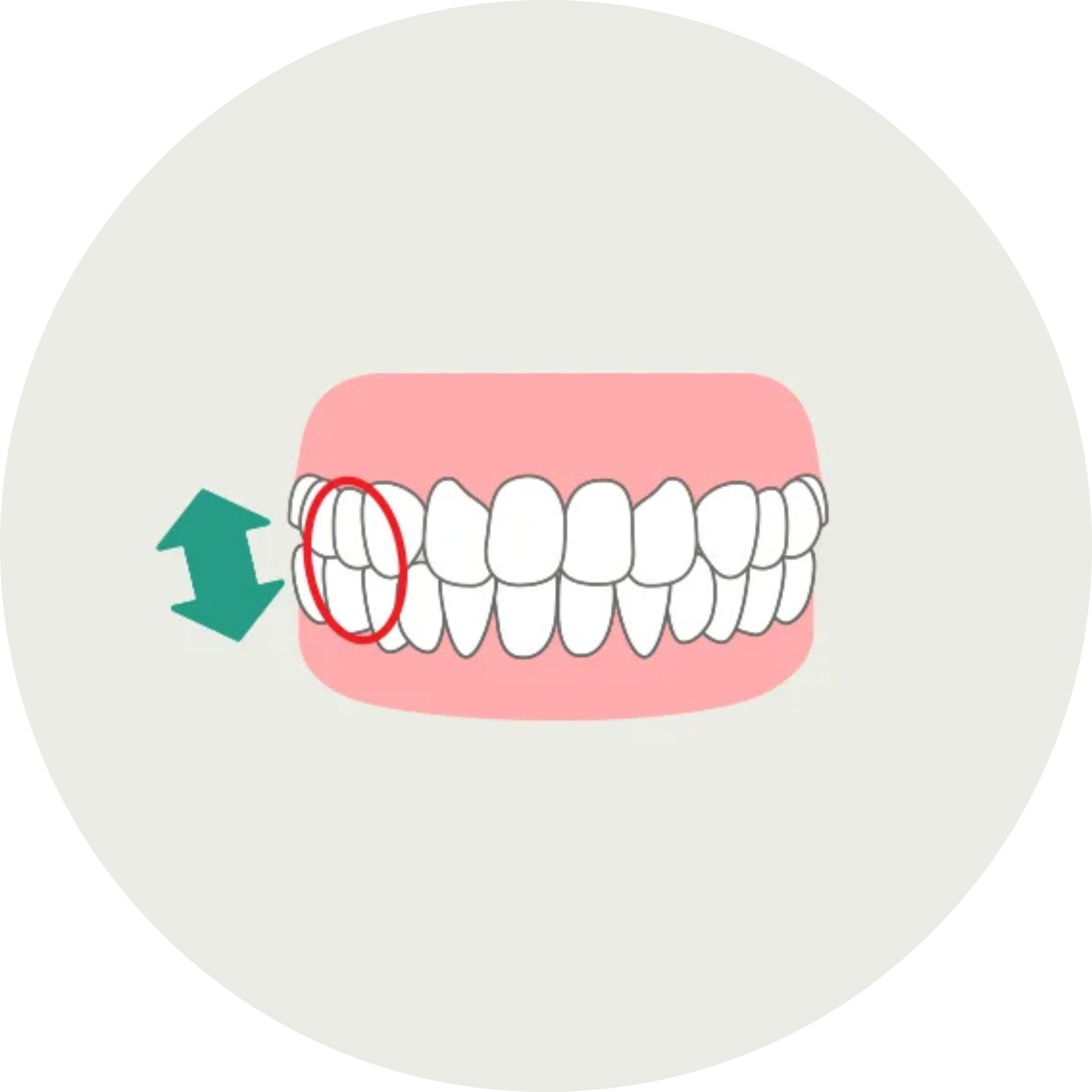 タッピング 歯ぎしりの種類 飯田橋IB歯科 飯田橋駅徒歩1分