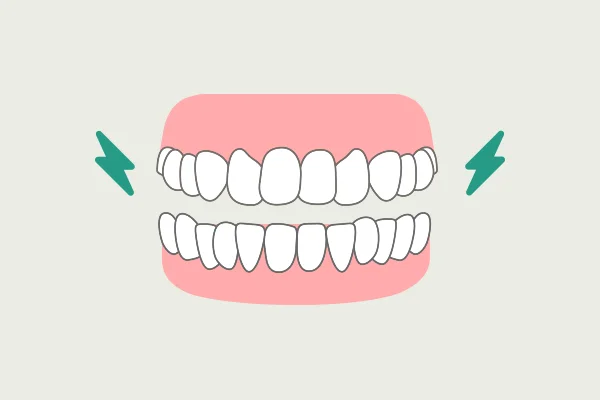 きしませ ナッシング 症状 歯ぎしりの種類 飯田橋IB歯科 飯田橋駅徒歩1分