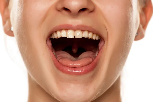 過剰な開口動作 顎関節症になってしまう原因 飯田橋IB歯科 飯田橋駅徒歩1分